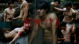 ANATOMY EP 84