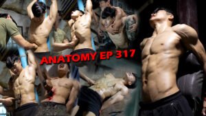 ANATOMY EP 317